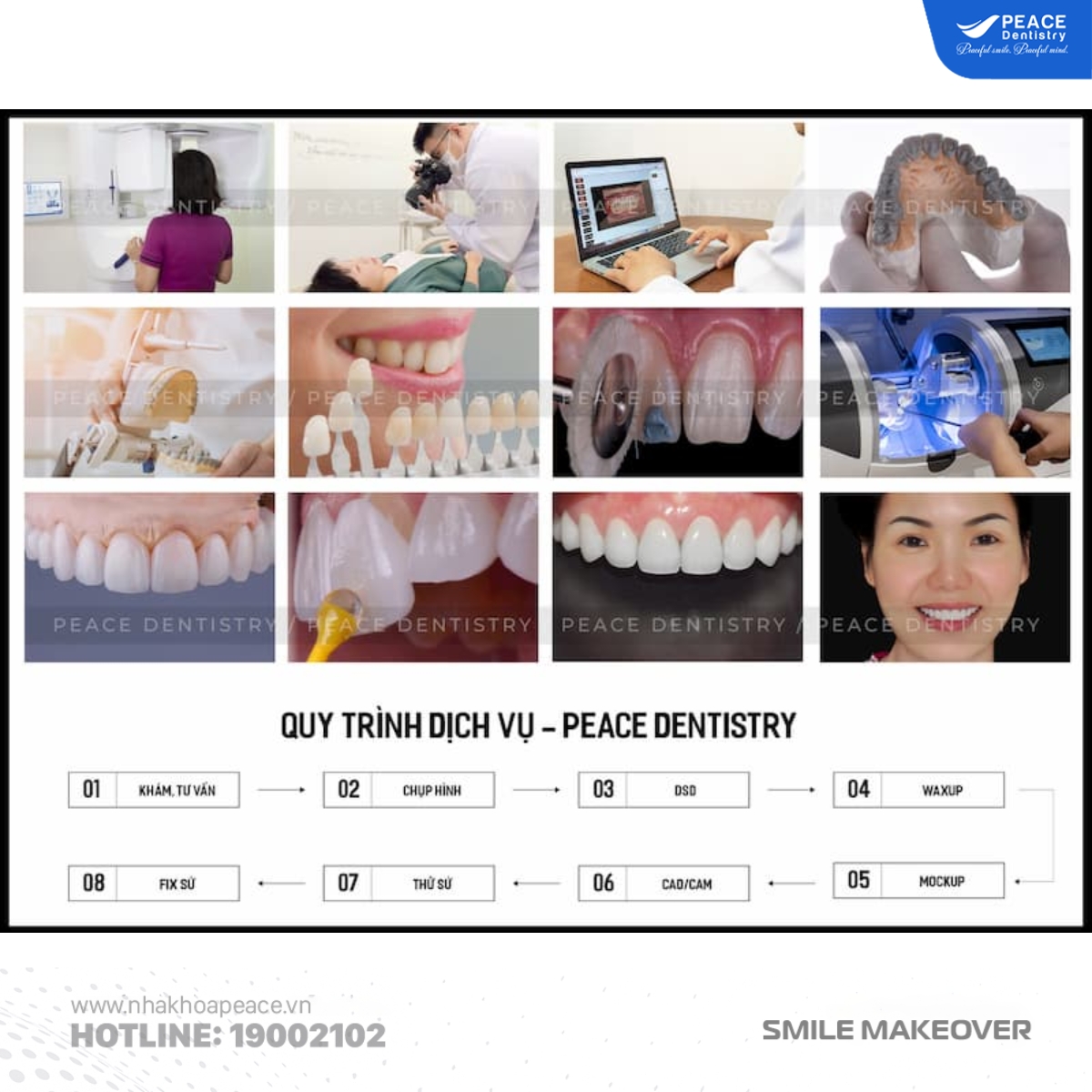 quy trình bọc răng sứ