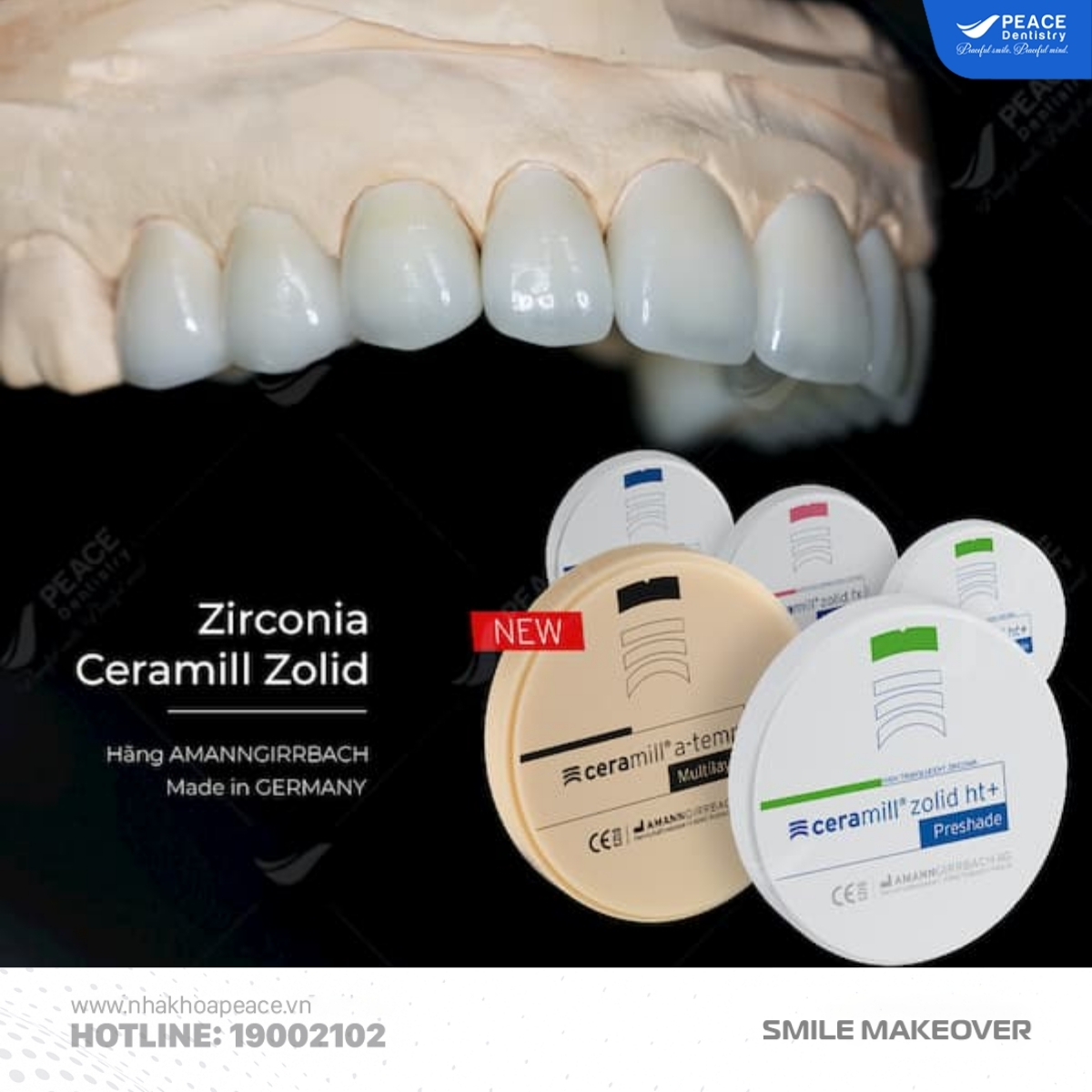 thẻ bảo hành răng sứ zirconia